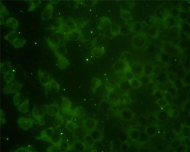 RAP2B Antibody in Immunocytochemistry (ICC/IF)