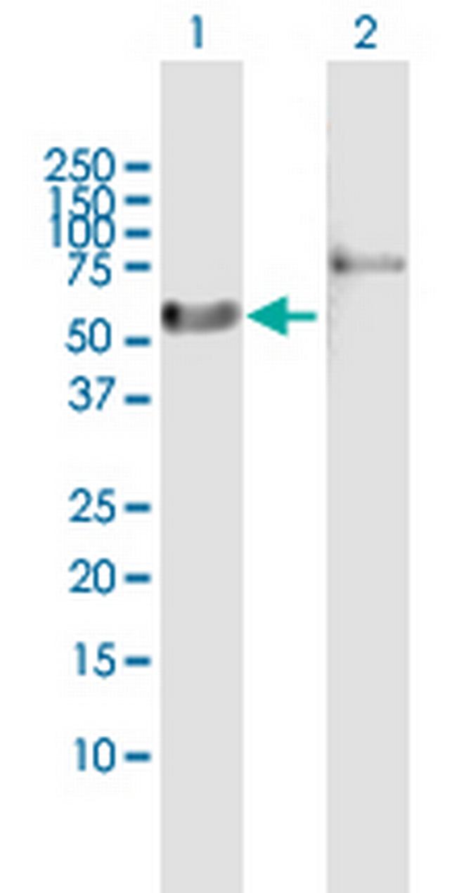 RARA Antibody in Western Blot (WB)