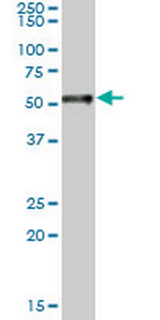 RARA Antibody in Western Blot (WB)