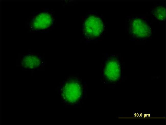 RARB Antibody in Immunocytochemistry (ICC/IF)