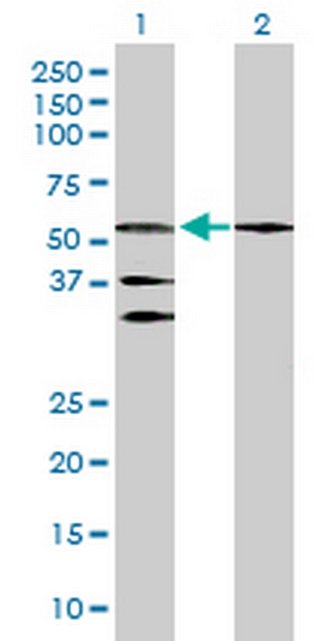 RARB Antibody in Western Blot (WB)