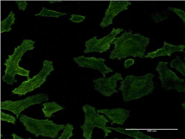 RASA1 Antibody in Immunocytochemistry (ICC/IF)