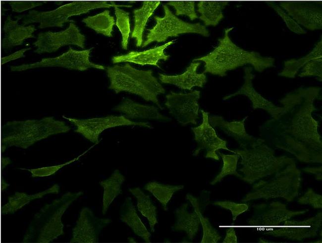 RASA1 Antibody in Immunocytochemistry (ICC/IF)