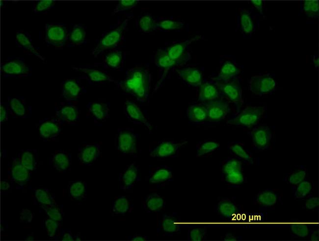 RBBP4 Antibody in Immunocytochemistry (ICC/IF)