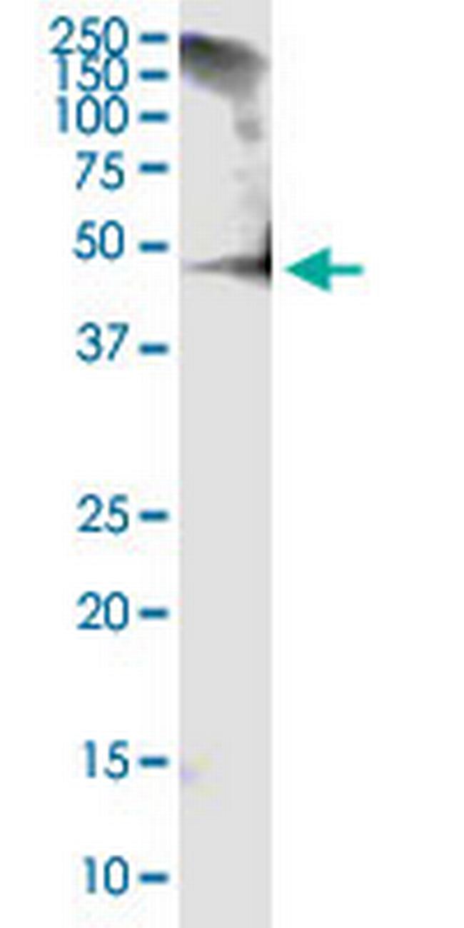 RCN1 Antibody in Western Blot (WB)