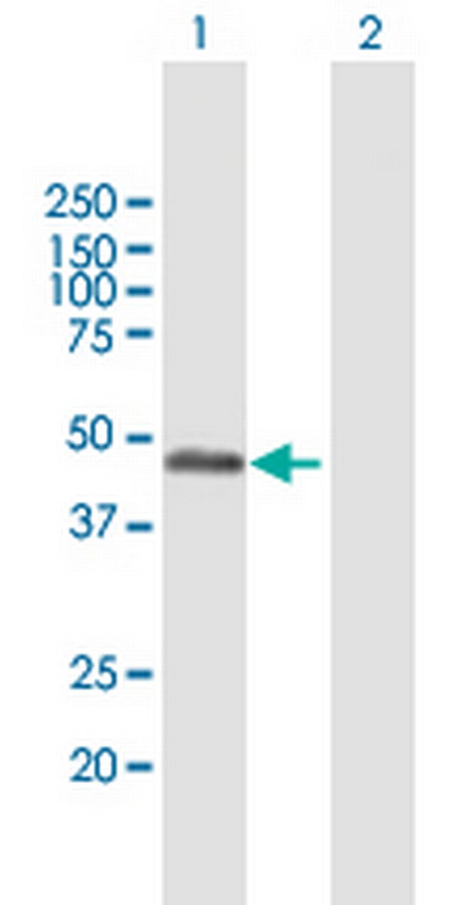 RCN2 Antibody in Western Blot (WB)