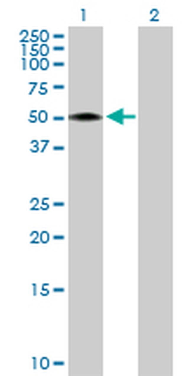 RCN2 Antibody in Western Blot (WB)