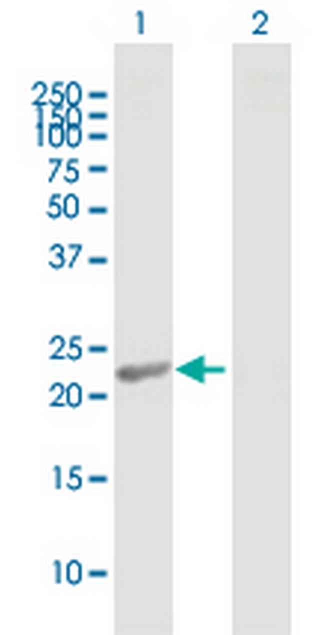 RCVRN Antibody in Western Blot (WB)