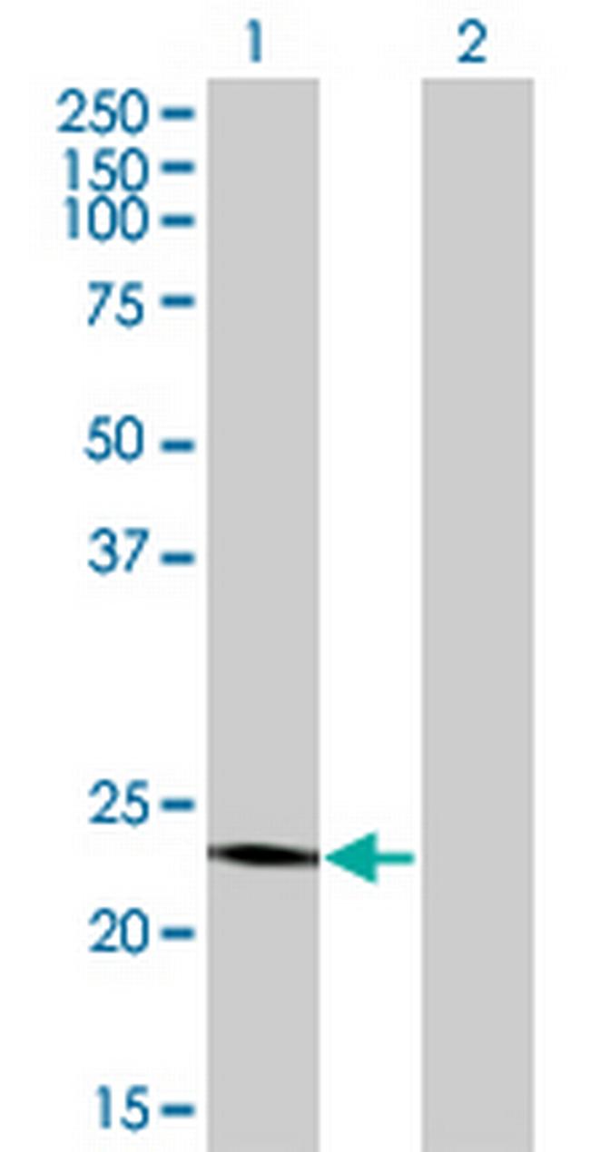 RCV1 Antibody in Western Blot (WB)