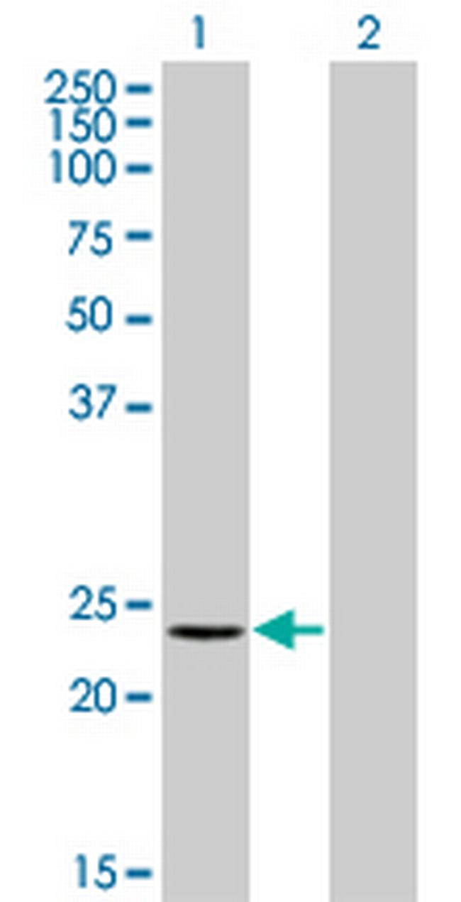 RCV1 Antibody in Western Blot (WB)