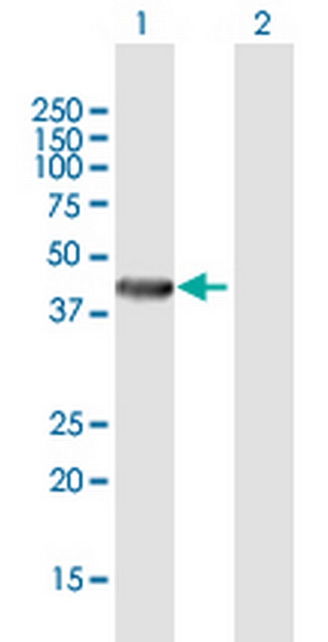 RENBP Antibody in Western Blot (WB)