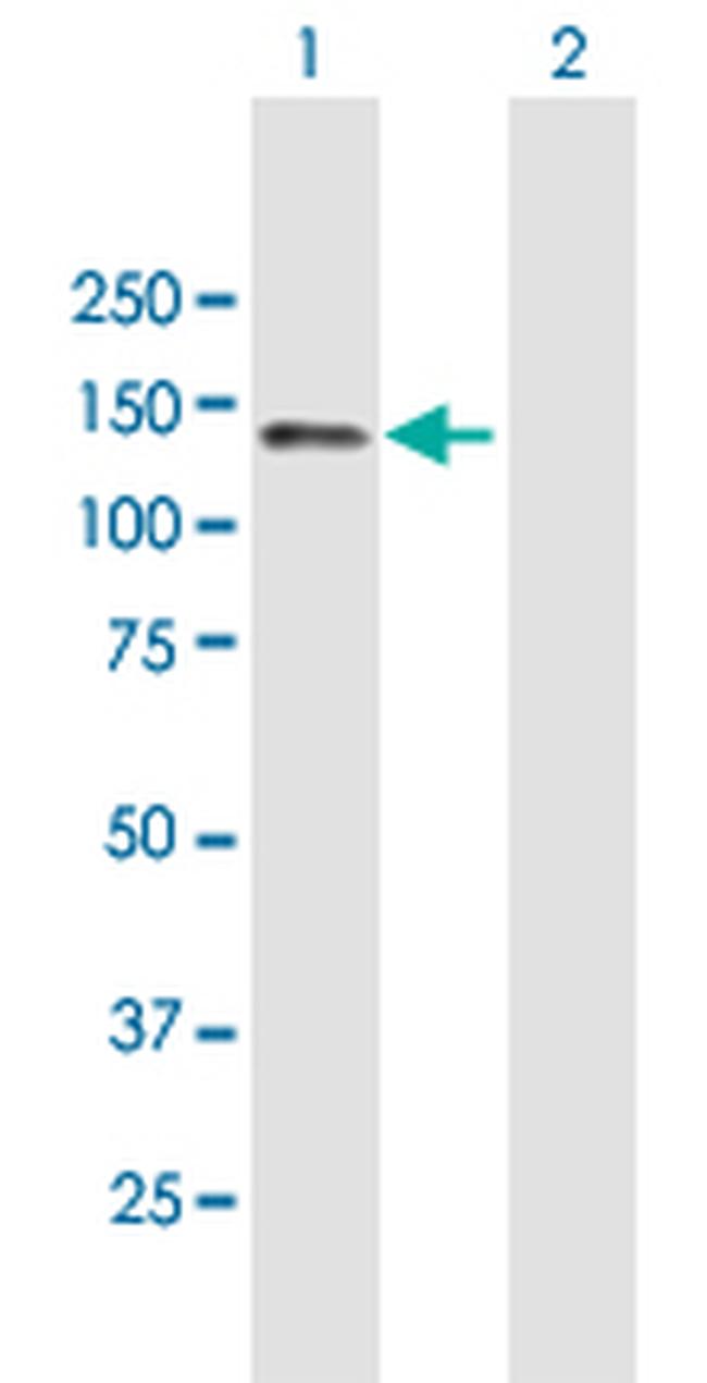 RET Antibody in Western Blot (WB)