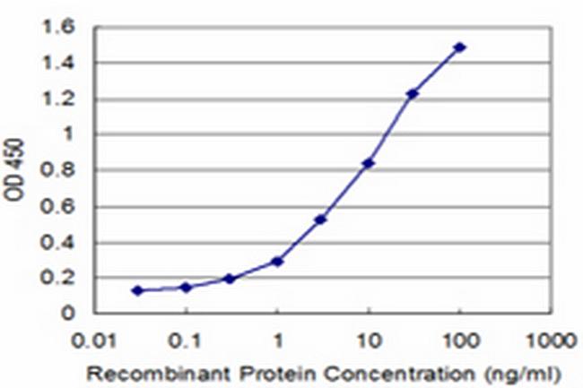 RFC4 Antibody in ELISA (ELISA)