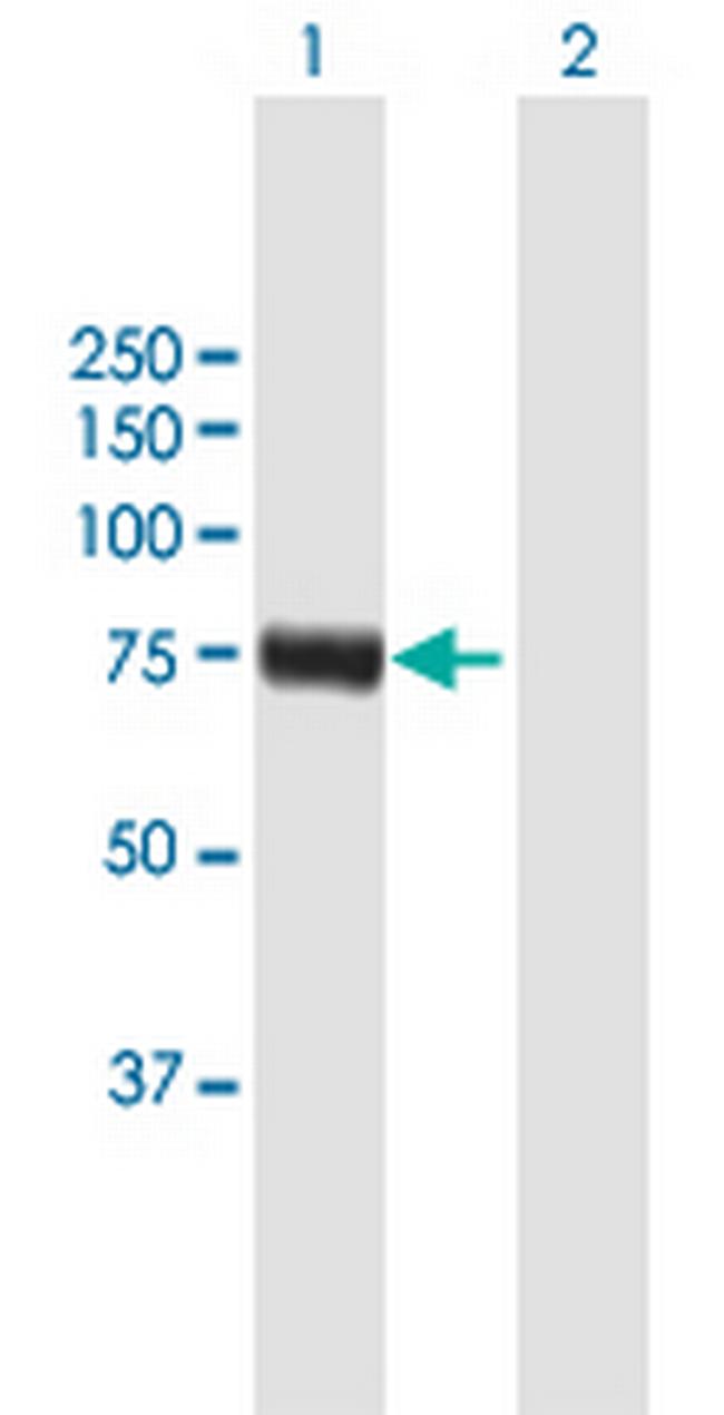 RFX4 Antibody in Western Blot (WB)