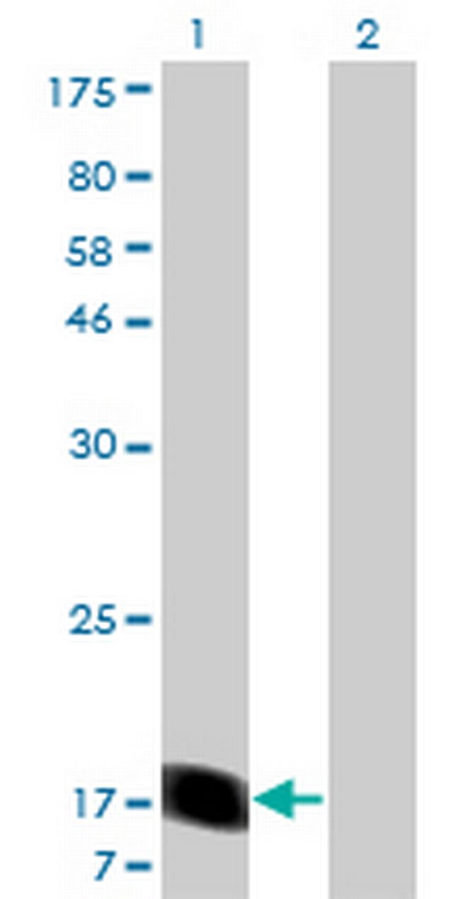 RHEB Antibody in Western Blot (WB)