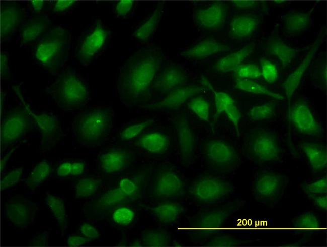 RLBP1 Antibody in Immunocytochemistry (ICC/IF)