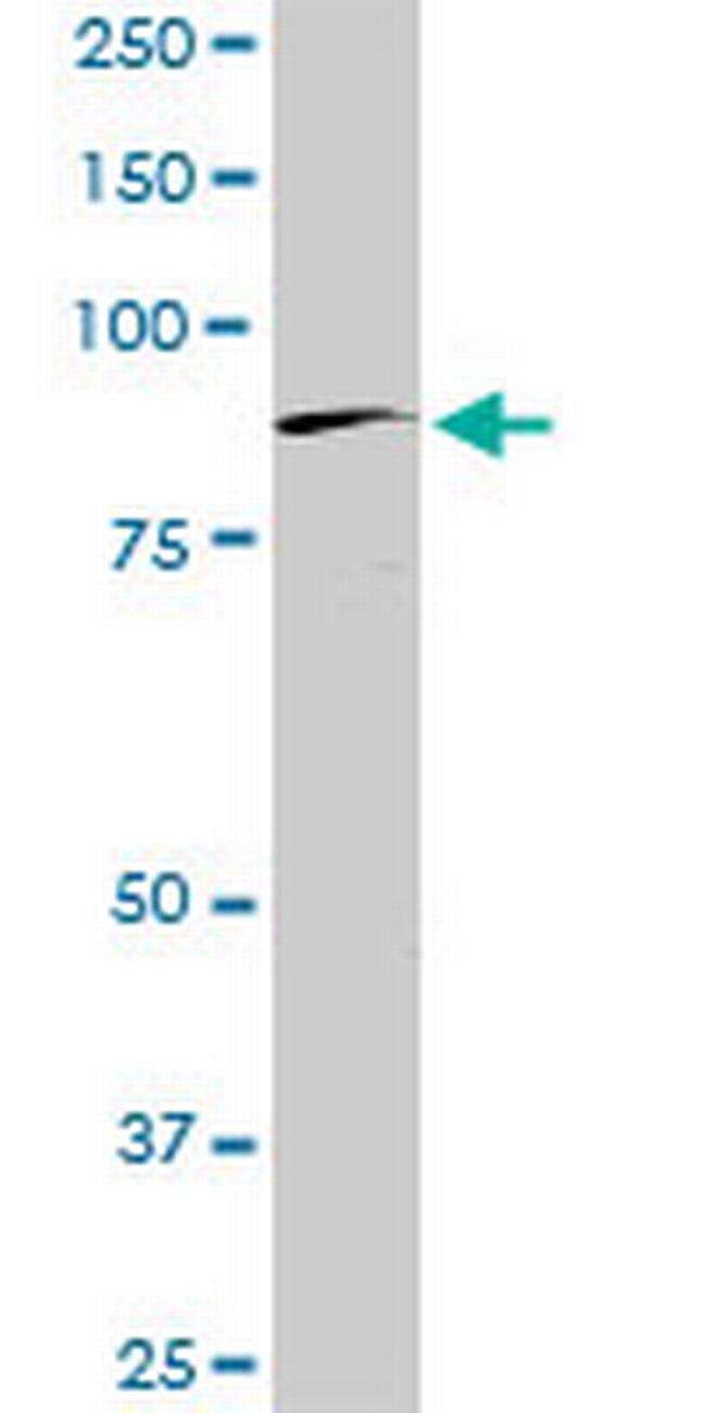 BRD2 Antibody in Western Blot (WB)