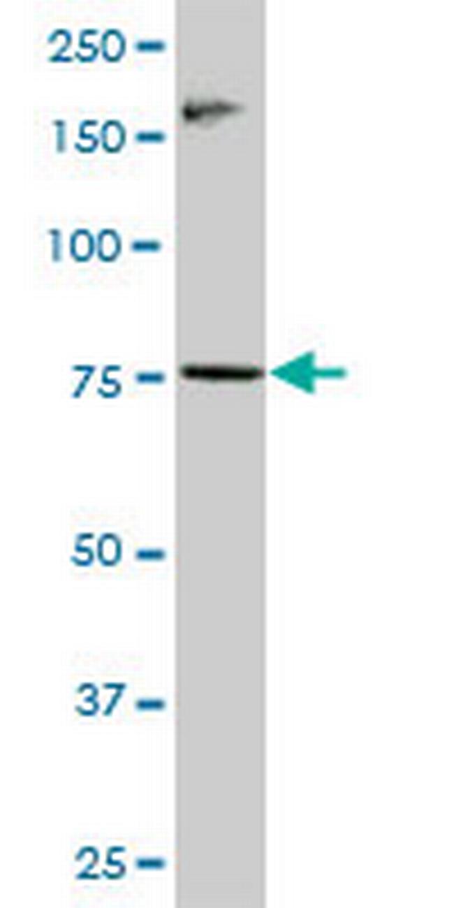 RNF6 Antibody in Western Blot (WB)