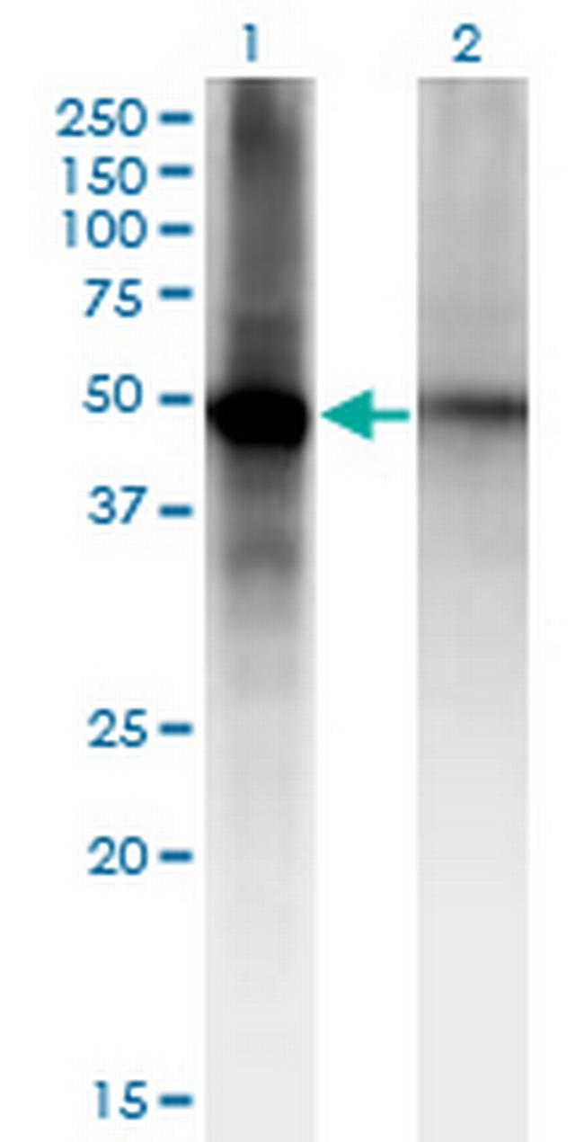 RORB Antibody in Western Blot (WB)