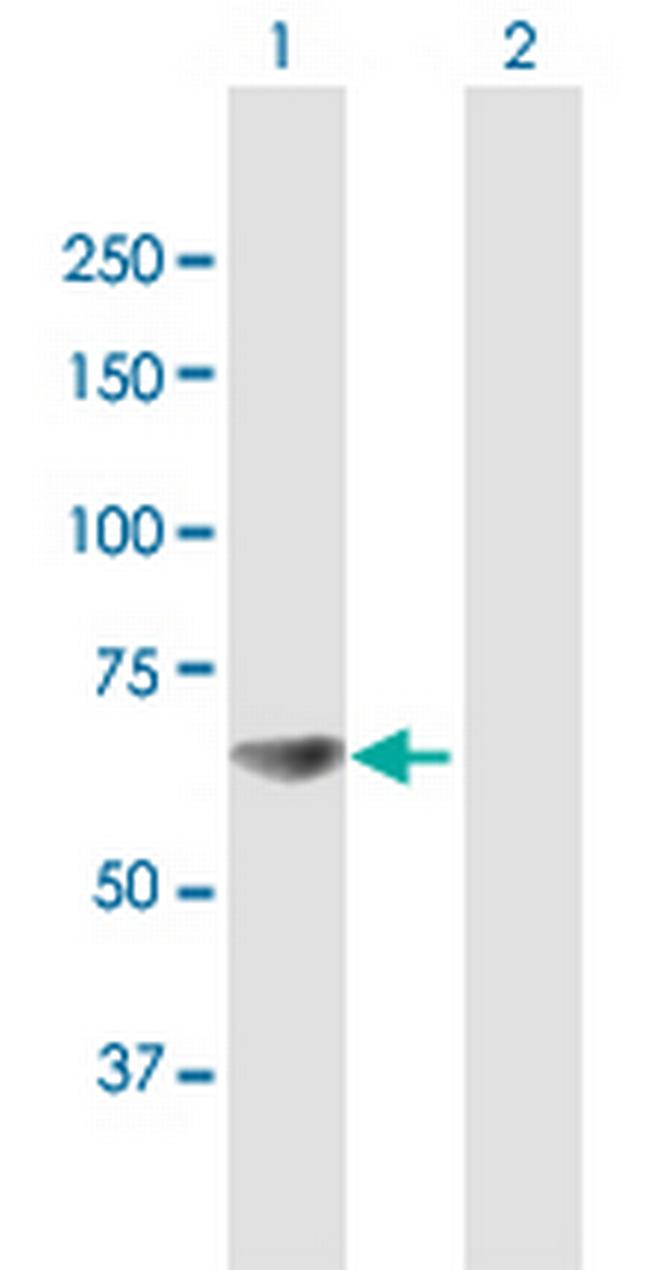 RPA1 Antibody in Western Blot (WB)