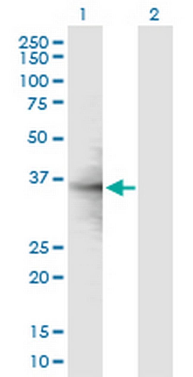 RPL6 Antibody in Western Blot (WB)