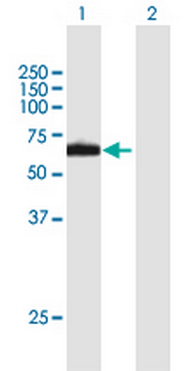 RPN2 Antibody in Western Blot (WB)