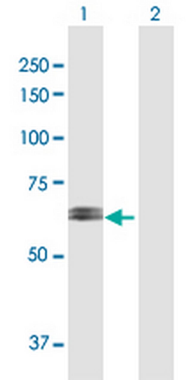 RPN2 Antibody in Western Blot (WB)