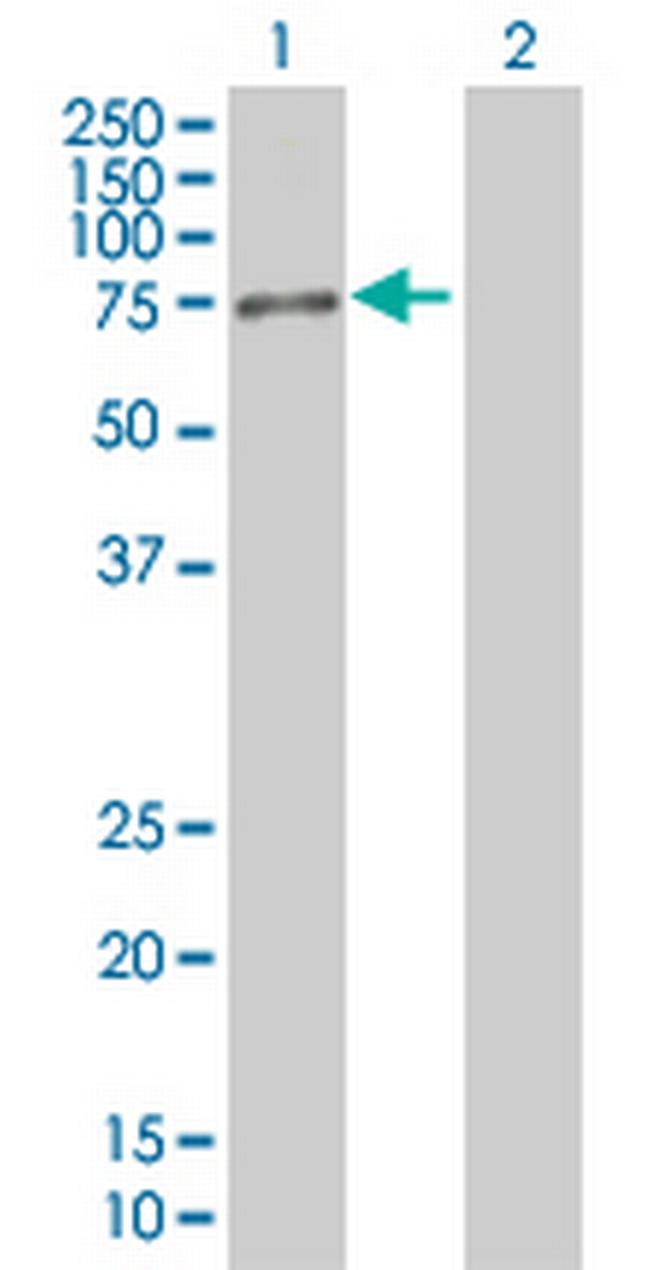 RPS6KA3 Antibody in Western Blot (WB)