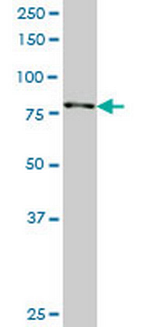 RPS6KA3 Antibody in Western Blot (WB)