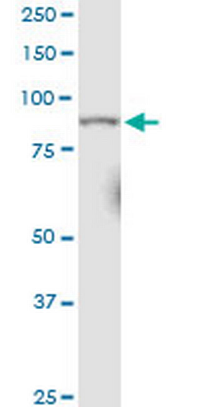 RRM1 Antibody in Western Blot (WB)