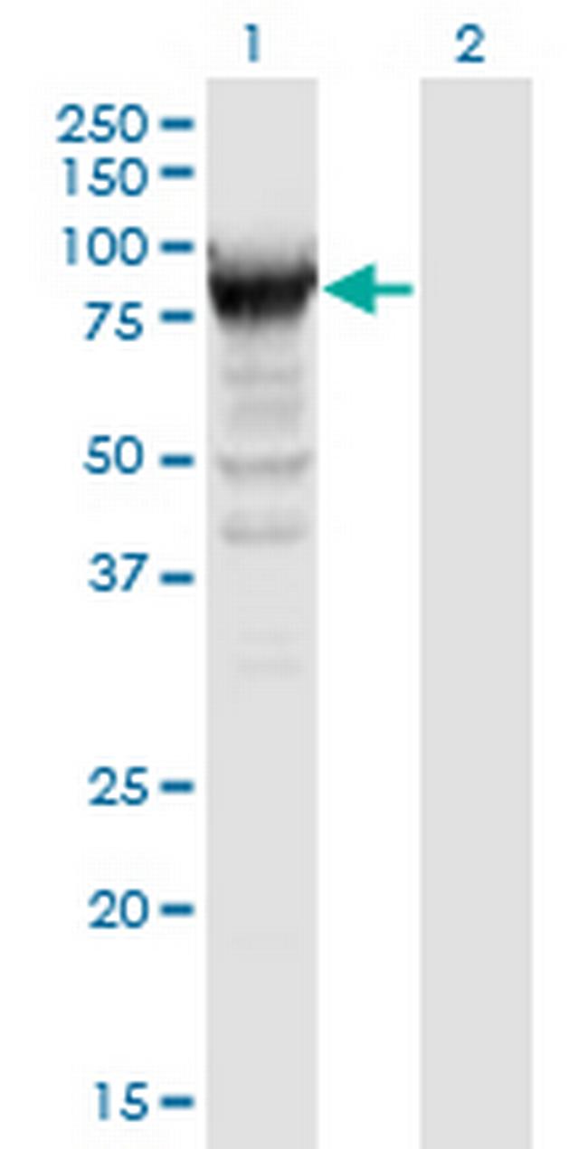 RRM1 Antibody in Western Blot (WB)