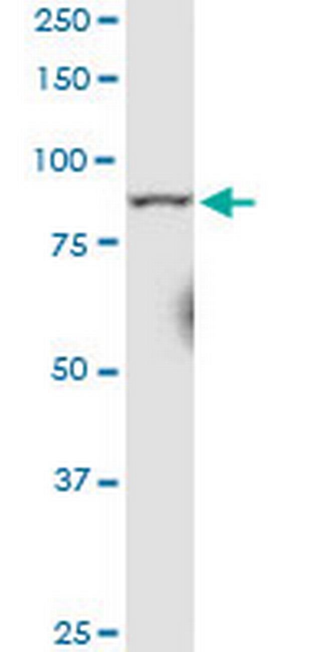 RRM1 Antibody in Western Blot (WB)