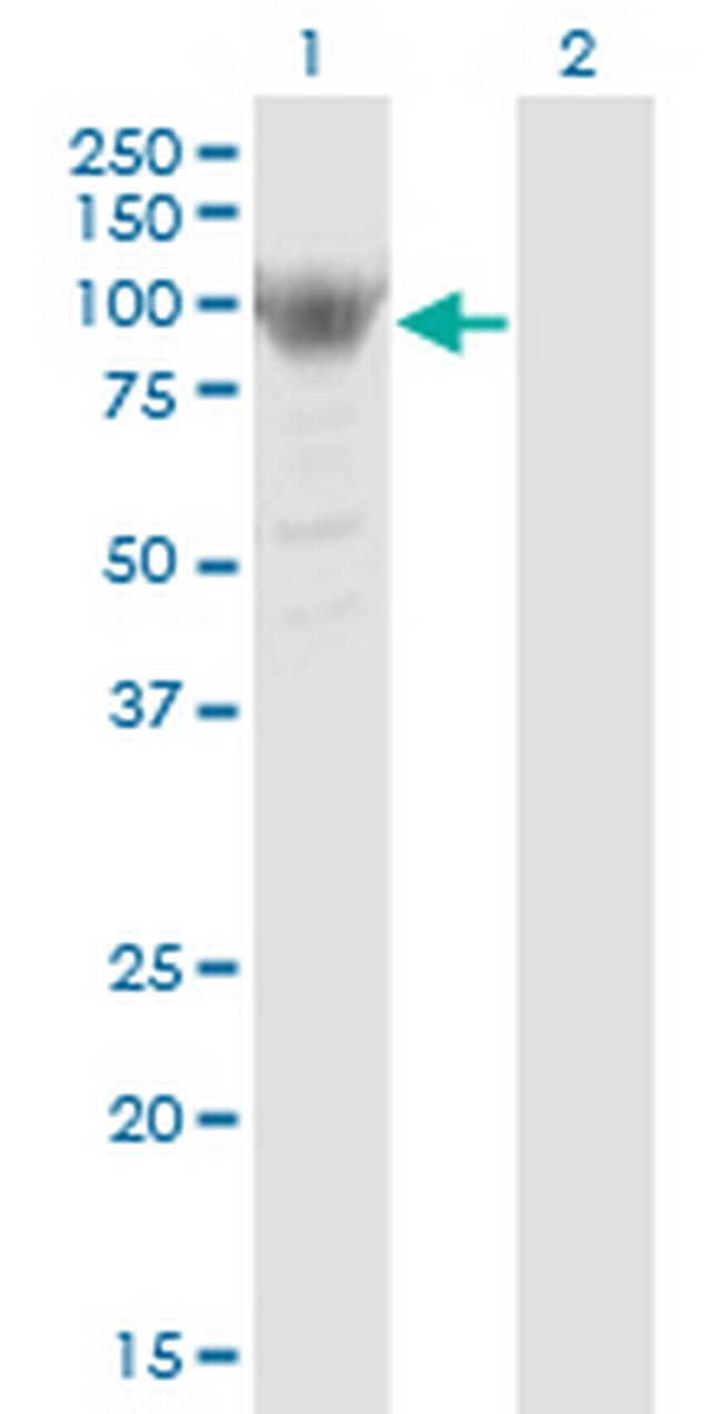 RRM1 Antibody in Western Blot (WB)