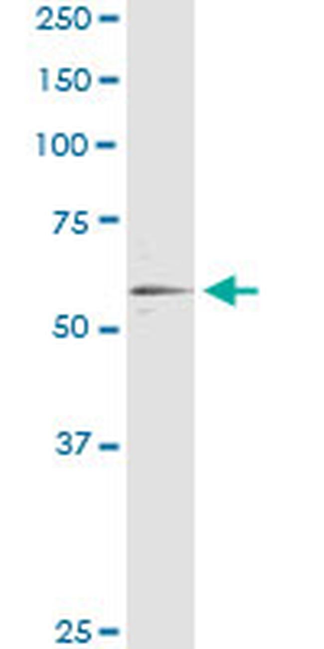 RXRA Antibody in Immunoprecipitation (IP)