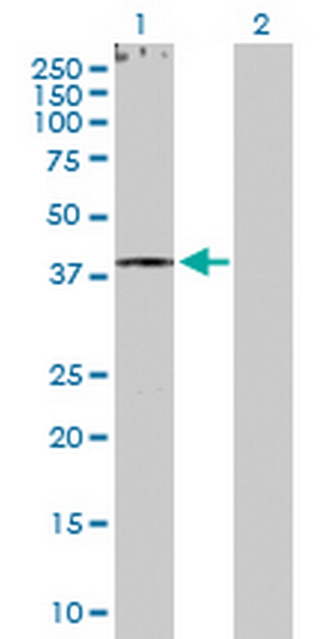 RXRG Antibody in Western Blot (WB)