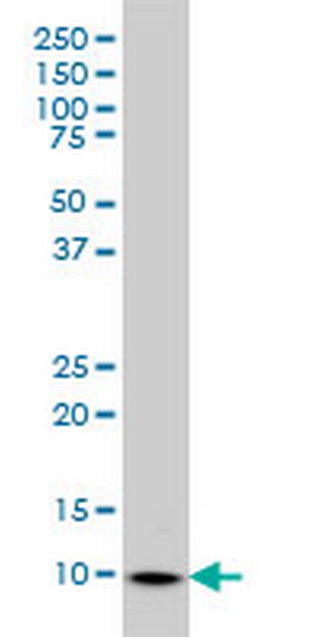 S100A6 Antibody in Western Blot (WB)