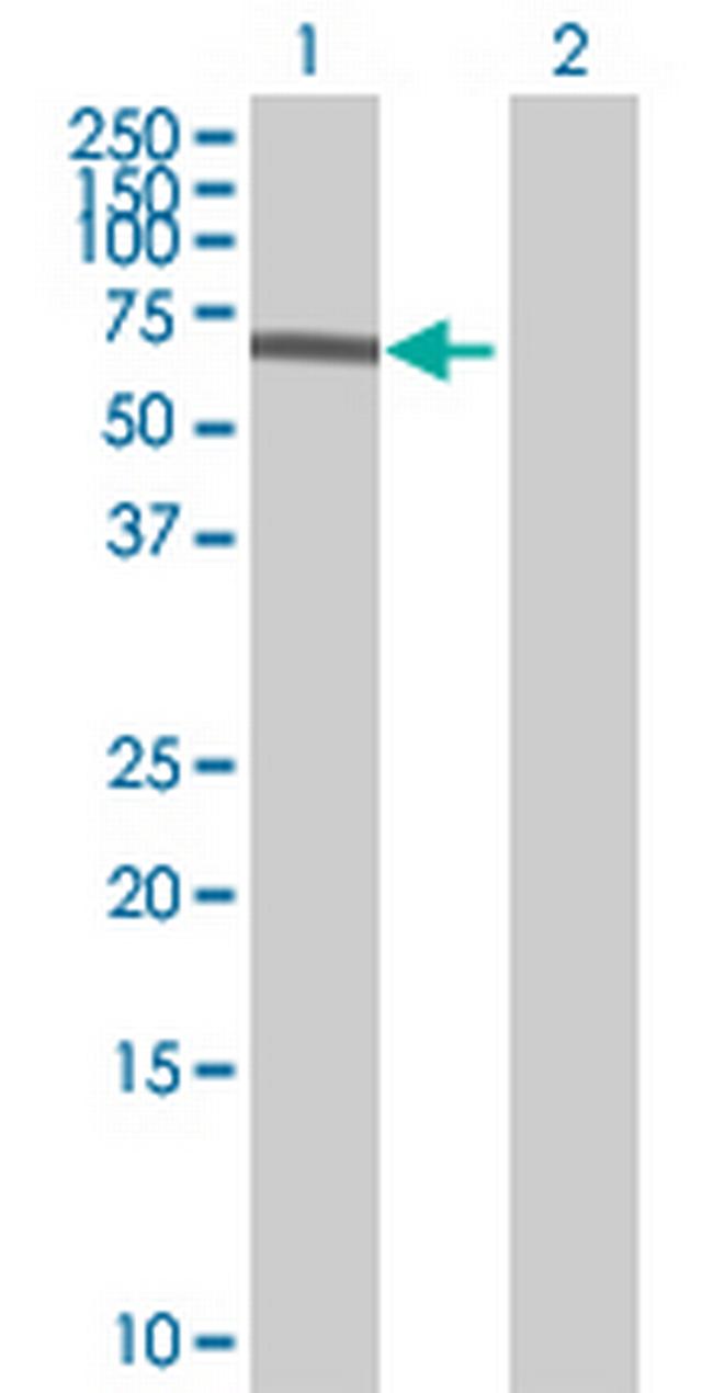 SARS Antibody in Western Blot (WB)