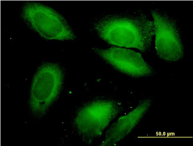 SARS Antibody in Immunocytochemistry (ICC/IF)