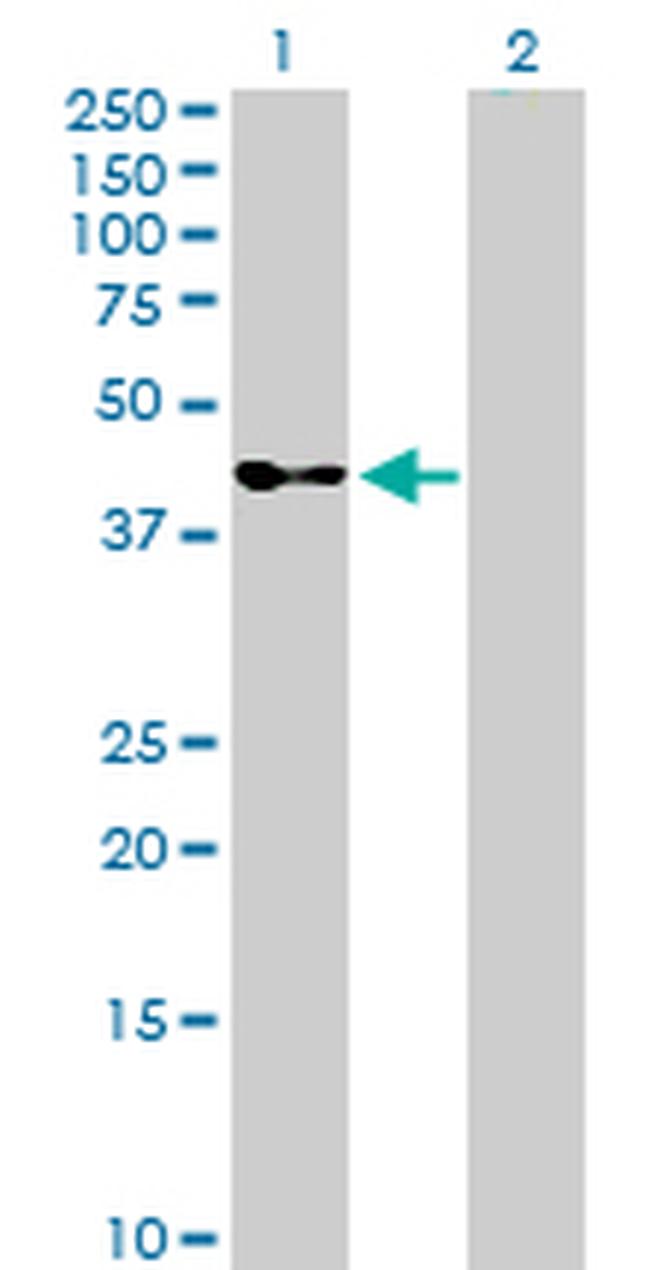 SERPINB3 Antibody in Western Blot (WB)