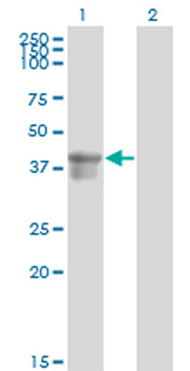 SERPINB3 Antibody in Western Blot (WB)