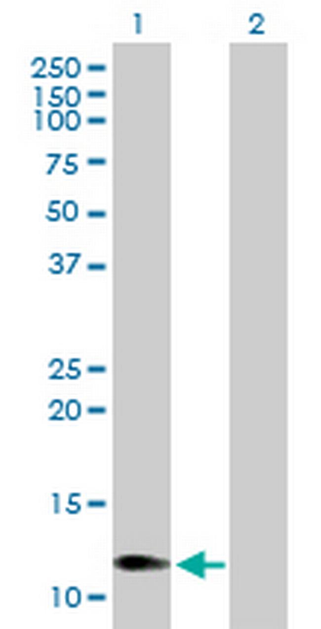 CCL1 Antibody in Western Blot (WB)