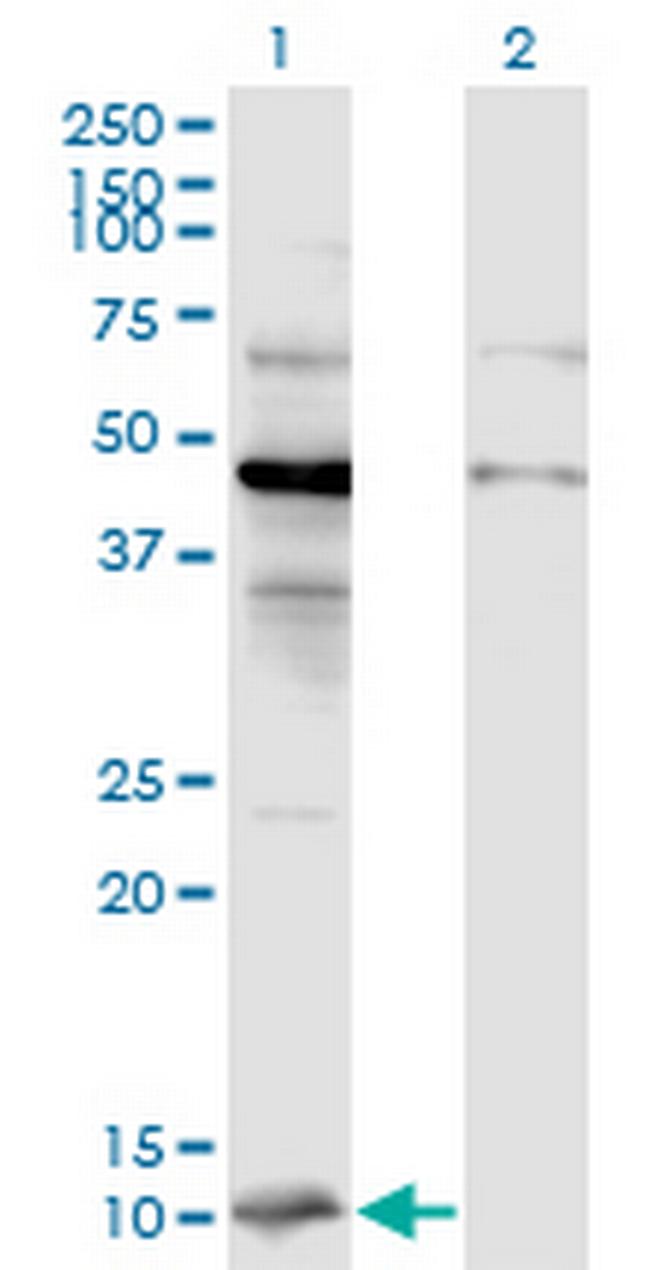 CCL2 Antibody in Western Blot (WB)