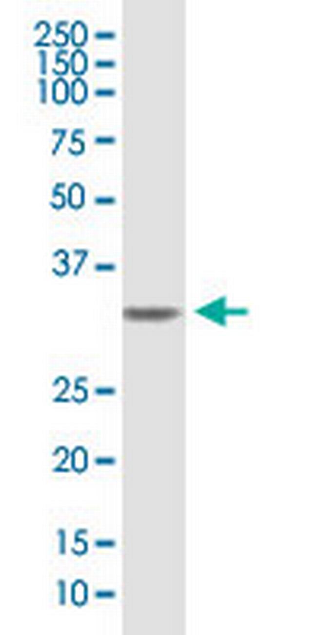 SDCBP Antibody in Western Blot (WB)