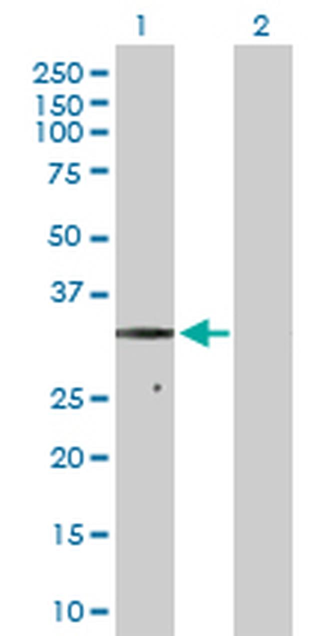 SDHB Antibody in Western Blot (WB)