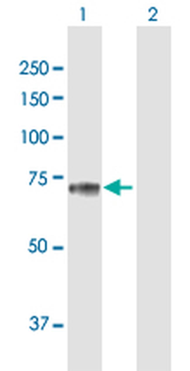 SEMG2 Antibody in Western Blot (WB)