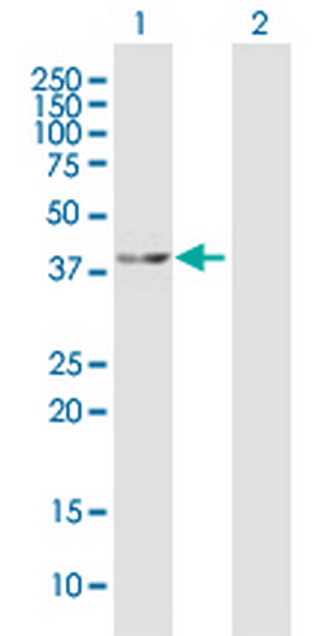 MAP2K4 Antibody in Western Blot (WB)