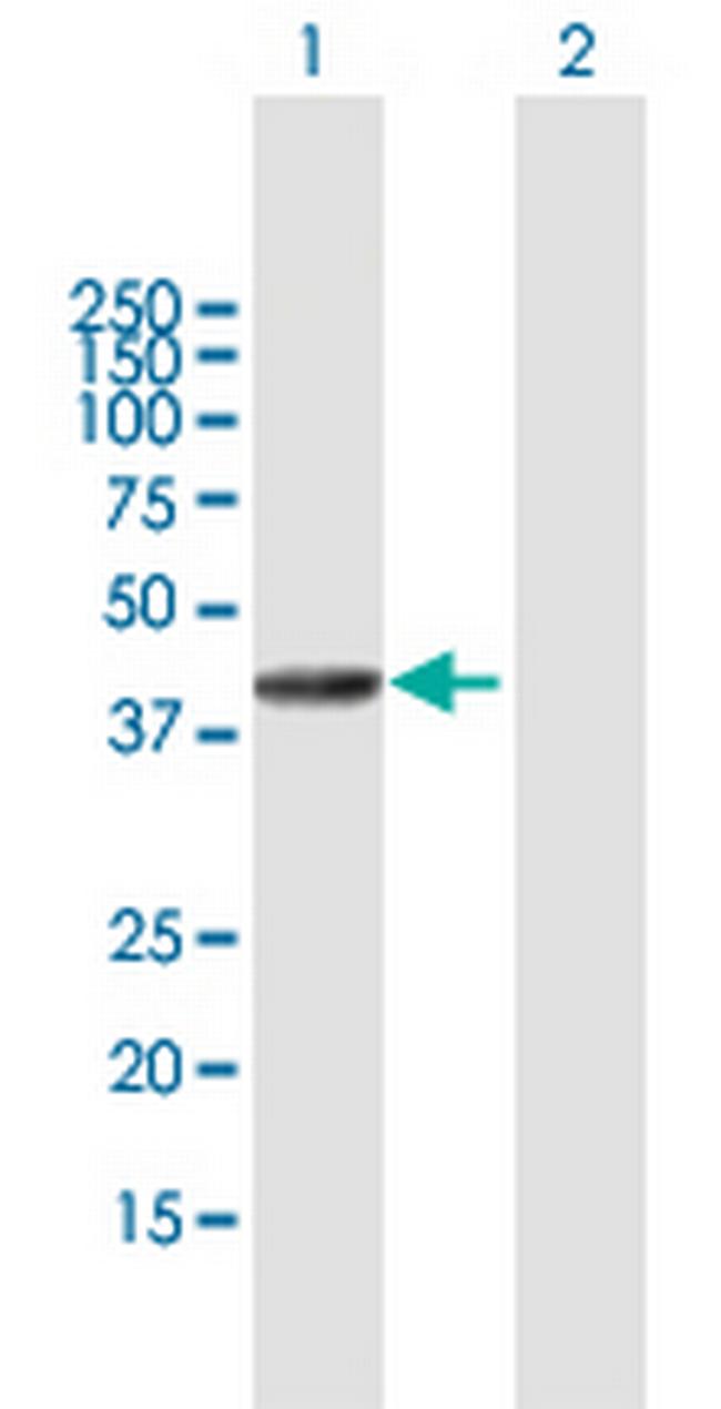 SETMAR Antibody in Western Blot (WB)