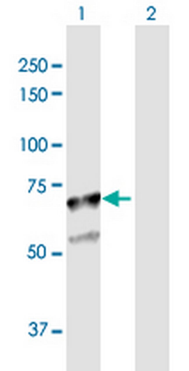 SGSH Antibody in Western Blot (WB)