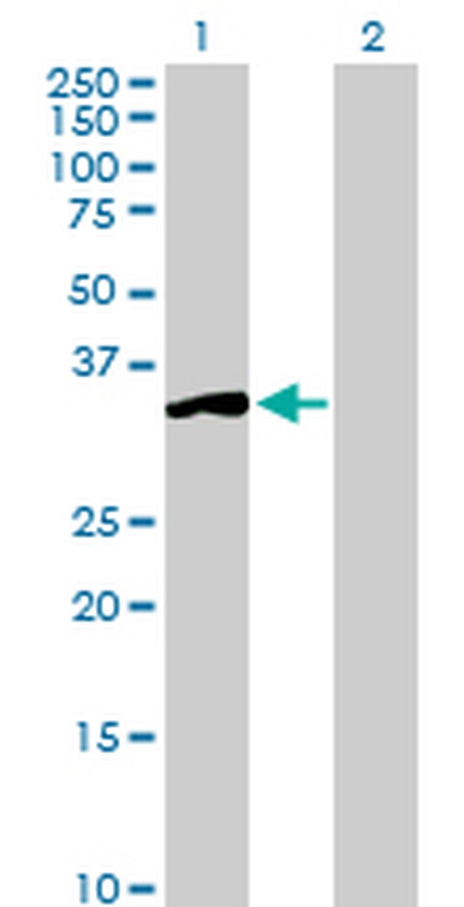 SGTA Antibody in Western Blot (WB)