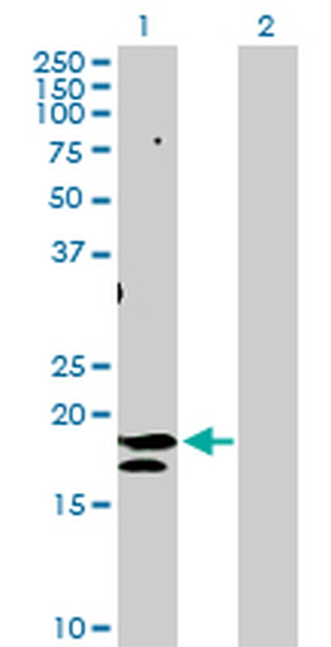 ST6GAL1 Antibody in Western Blot (WB)